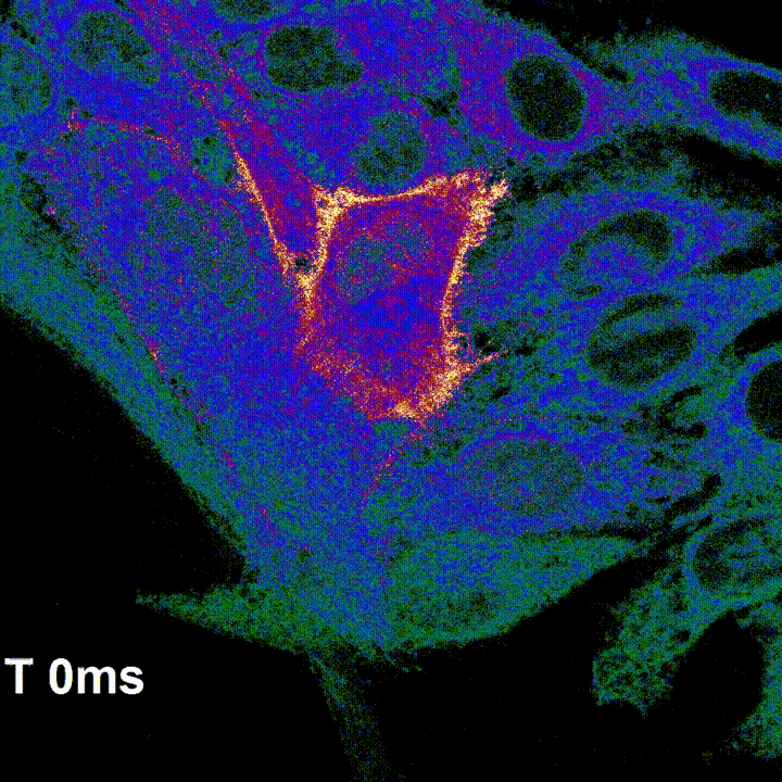 W020250508356224093572.gif